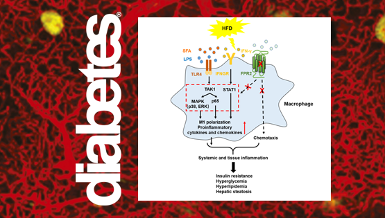 乐颖影研究组发现高脂饮食导致肥胖和糖脂代谢紊乱的新机制