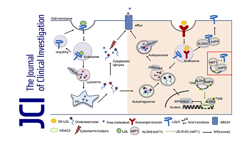 尹慧勇研究组发现乙醛脱氢酶2调控动脉粥样硬化的新机制