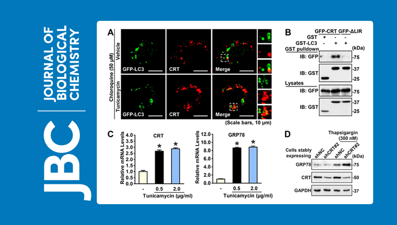 李于研究组发现关键内质网伴侣蛋白协同自噬途径负反馈调节细胞应激反应的新机制