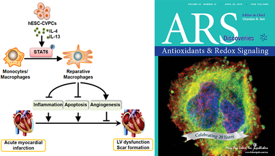 杨黄恬研究组揭示人胚胎干细胞（hESCs）来源的心血管前体细胞（CVPCs）移植对急性心肌梗死的?；ぷ饔? />
                                    </div>
                                    <div   id=