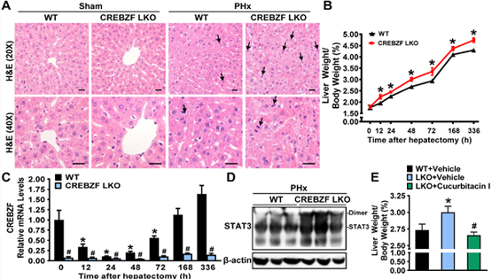 李于研究组发现CREB/ATF碱性亮氨酸拉链转录因子调控肝脏组织再生的新机制