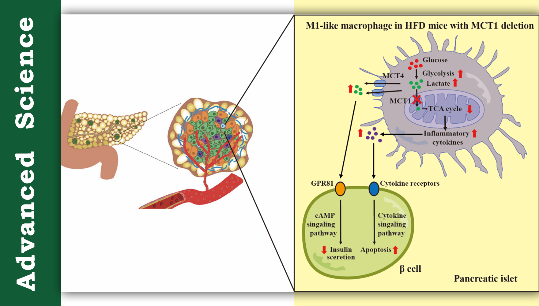 营养与健康所陈雁研究组发现乳酸穿梭调控巨噬细胞极化并参与2型糖尿病进程