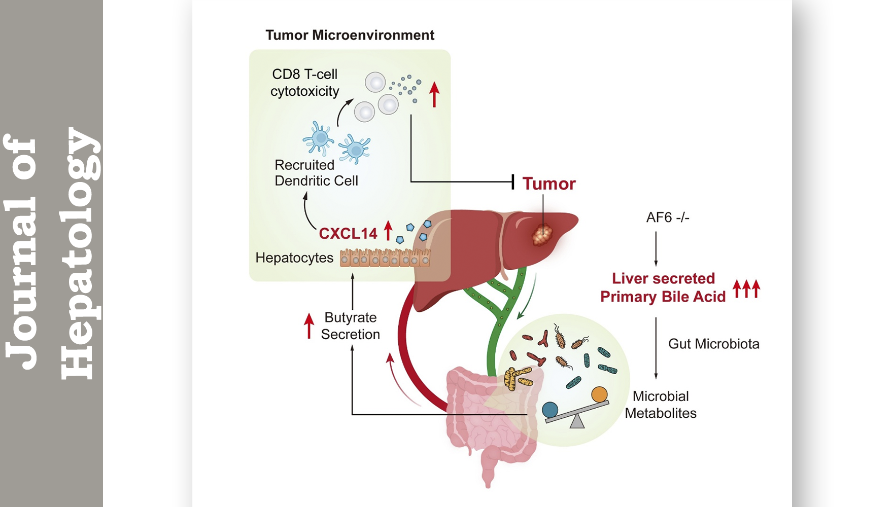 营养与健康所詹丽杏研究组合作揭示肝癌中胆汁酸代谢-免疫作用轴调控抗肿瘤免疫新机制