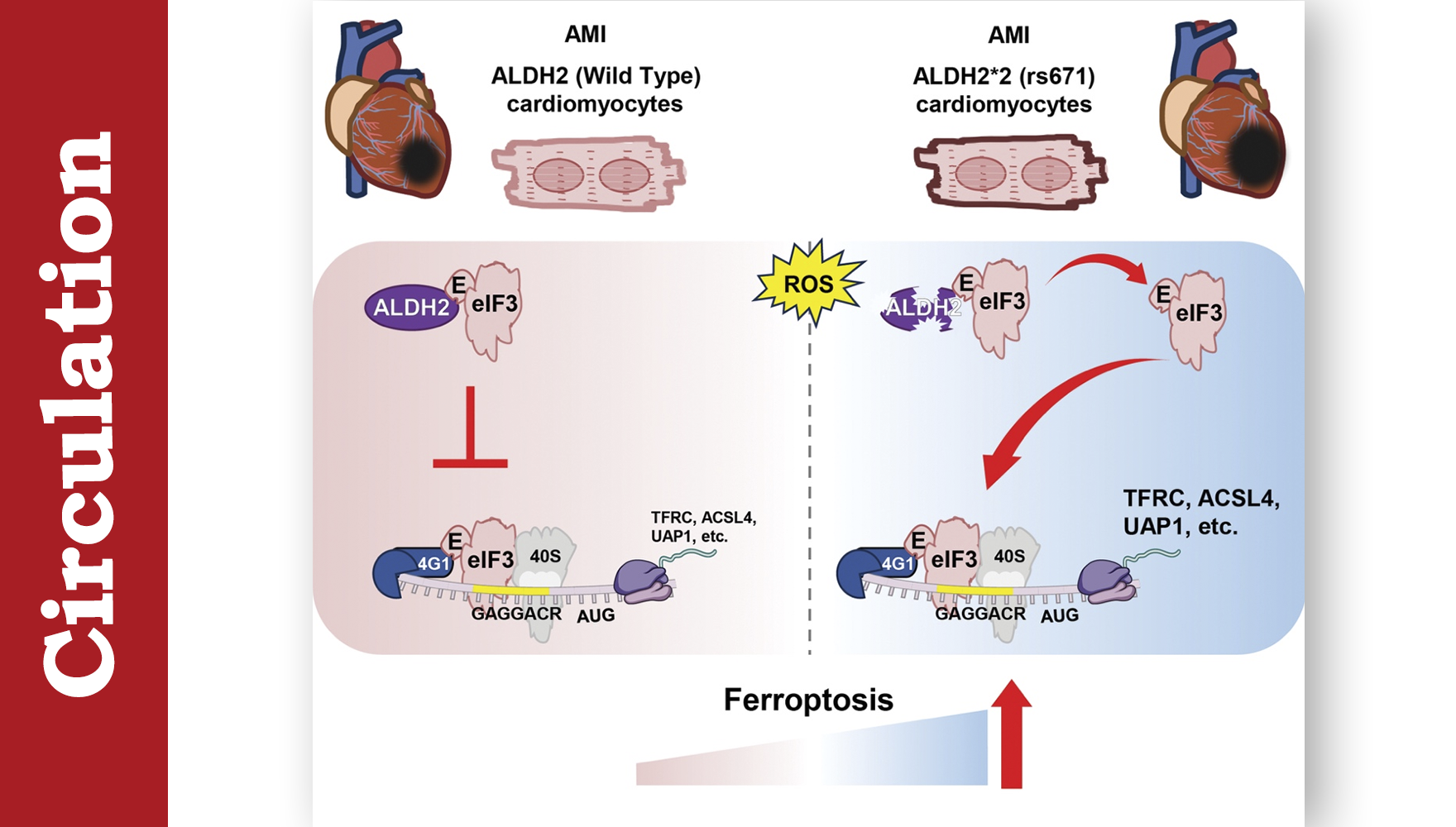 营养与健康所尹慧勇团队合作揭示心肌梗死过程中蛋白翻译调控心肌细胞铁死亡机制